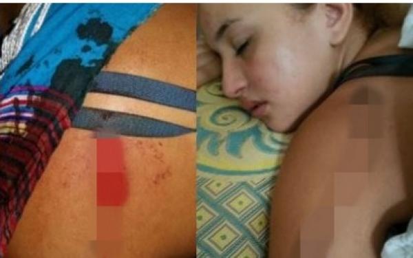 فتاة قاصر تنجو من موت محقق بعد تعرضها لمحاولة اغتصاب بفاس