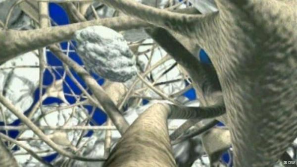 تلف في الذاكرة - معاناة مرضى "ألزهايمر" في المغرب