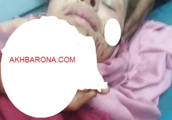 خطير:شخص "يُشرمل" زوجته  بطريقة وحشية وهذا ما وقع(صور صادمة)