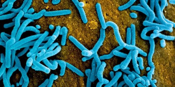 الصحة العالمية تعقد اجتماعا عاجلا حول فيروس "ماربورغ" الفتاك