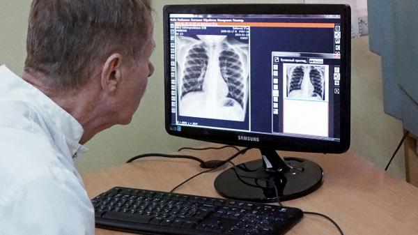 طبيب روسي يوضح: هذا أفضل غذاء يمكن تناوله لتقوية وظائف الرئتين