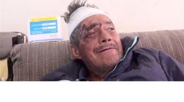  رجل يعود لأسرته بعد شهرين من حرق جثته