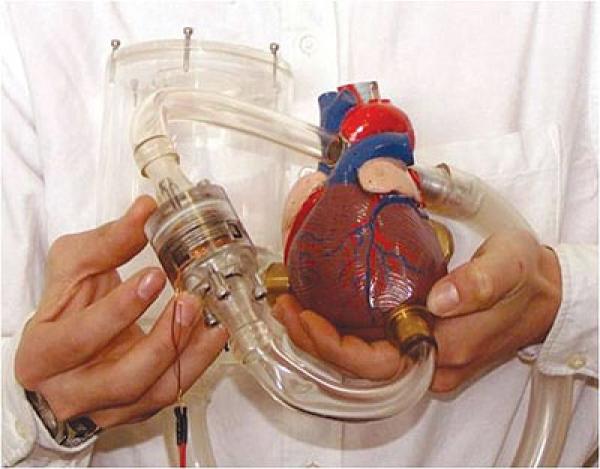 باحثون يتوصلون إلى جزئيات تحد من رفض الجسم زراعة العضو