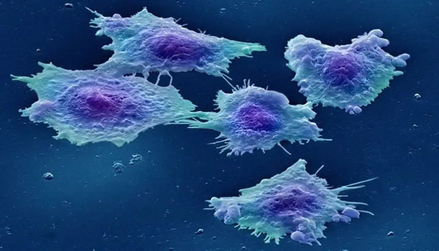 تقنية جديدة تجمع بين الضوء والنانو تفتح آفاقاً واعدة لعلاج السرطان