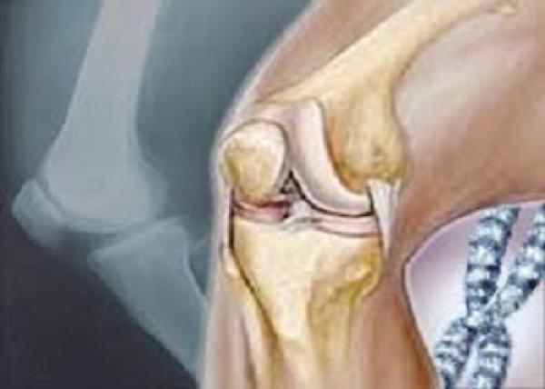 هل تعلم كيف يعمل المفصل ؟