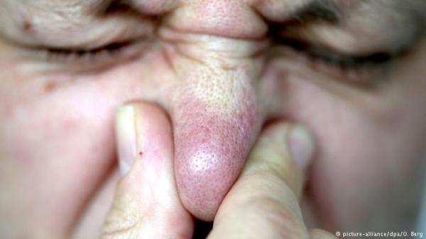 لا تغلق فمك وأنفك عند العطس!