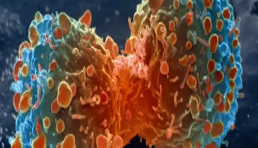 علاج جديد يعيد الأمل لمرضى سرطان البنكرياس: الأجسام المضادة تكشف "التمويه السكري"