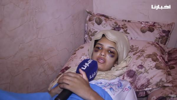 شيماء ..شابة جميلة حديثة الزواج تعرضت للتعنيف من طرف زوجها