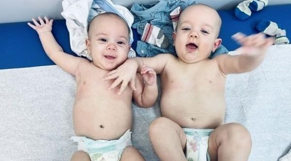 تنجب طفلين توأم "معجزة" من خلال حملها بأحدهما وهي حامل بالآخر