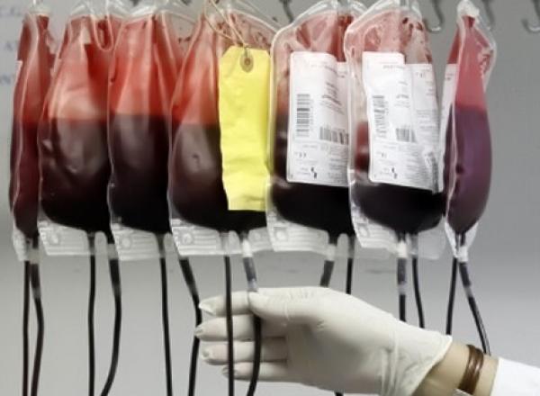 دراسة: الدم المخزن يفقد فاعليته بمرور الزمن