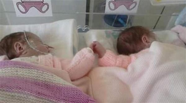 صورة: رضيعتان توأم تمسكان أيدي بعضهما في المستشفى