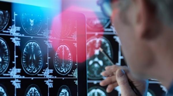 كورونا قد تتسبب بأعراض عصبية خطيرة على مصابيها