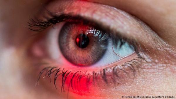 حدقة العين قد تكشف مبكرا عن مرض الزهايمر