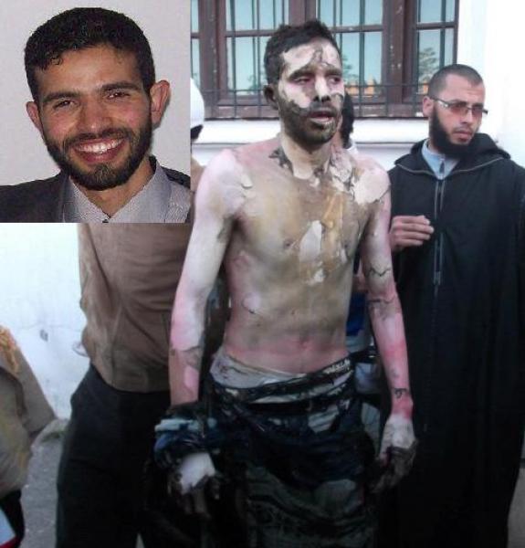 وفاة واحد من المعطلين الثلاثة الذين احرقوا أنفسهم أمام الوزارة 