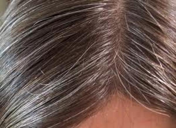 ظهور الشعر الأبيض أحد علامات الصحة الجيدة