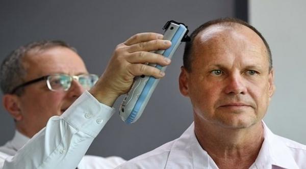 ماسح ضوئي محمول باليد يكشف عن نزيف داخلي في الدماغ