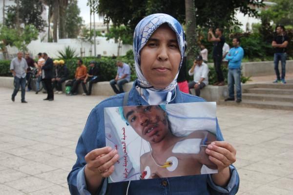 بفضل المحسنين ..الطفل "المدهوس" في جرادة يغادر للعلاج في تركيا وهذا المبلغ الذي تم تجميعه (فيديو)