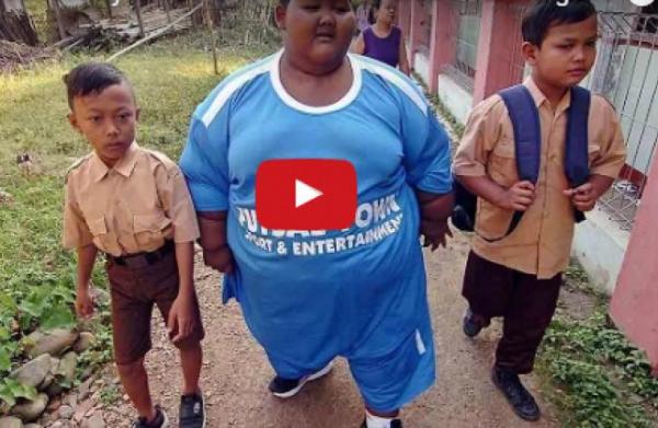 هل تذكرون أسمن طفل في العالم؟ هذا ما أصبح عليه الآن