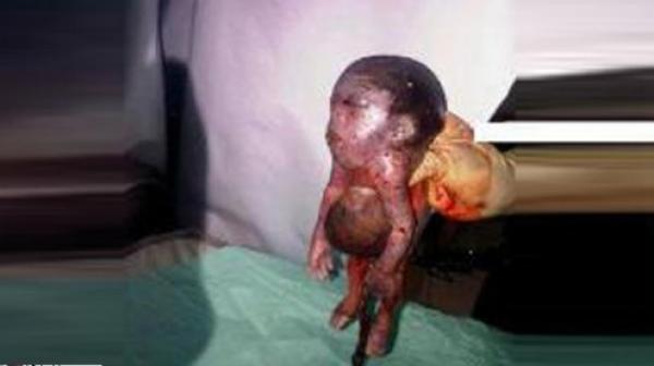 سيدة تضع مولوداً برأس إنسان وأرجل ماعز