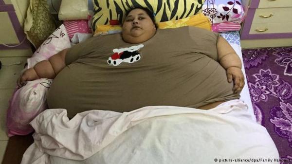 مهمة صعبة في الهند لإنقاذ حياة أثقل امرأة في العالم