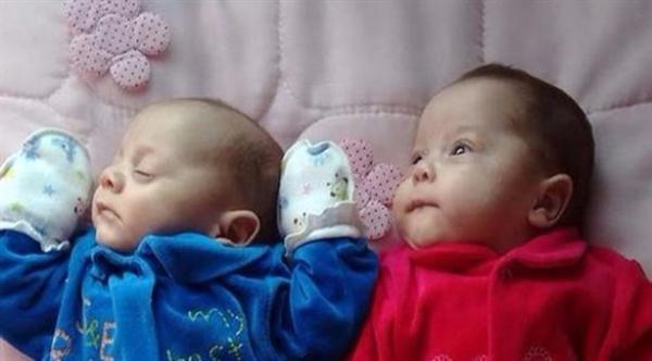 ولادة توأمين توفيت والدتهما دماغياً منذ أشهر