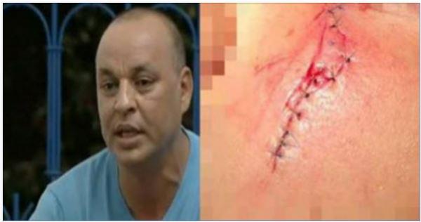 عبد الله ديدان في ورطة حقيقية بعد تسببه في جروح بليغة لنادل مطعم بالرباط