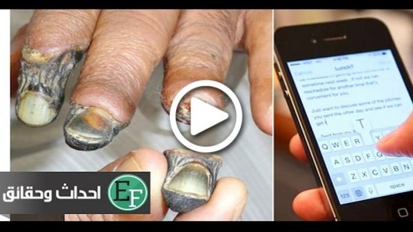 5 عادات يومية تهدد حياتك بالكامل، تعرف عليها قبل فوات الأوان..!!