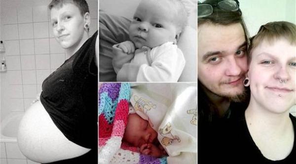 رجل ينجب طفلة بعملية قيصرية.. بعدما اكتشاف حمله متأخراً