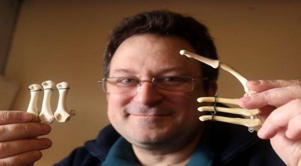 جراح يستخدم عظام الدجاج المشوي في عملياته التجميلية