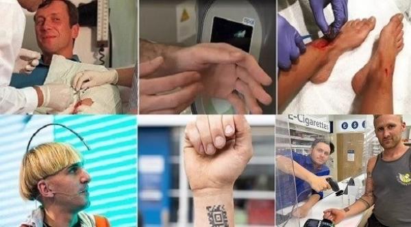 أشخاص زرعوا أجهزة إلكترونية في أجسامهم ..تعرف على أغرب حالات التعديلات التكنولوجية على الأجسام
