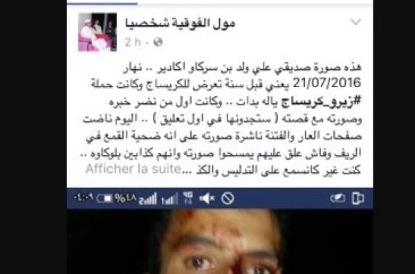 آخر طرق إشعال الفتنة في الريف...صفحات تنشر صور مصابين في عمليات "كريساج" على أنها لاعتداءات أمنية