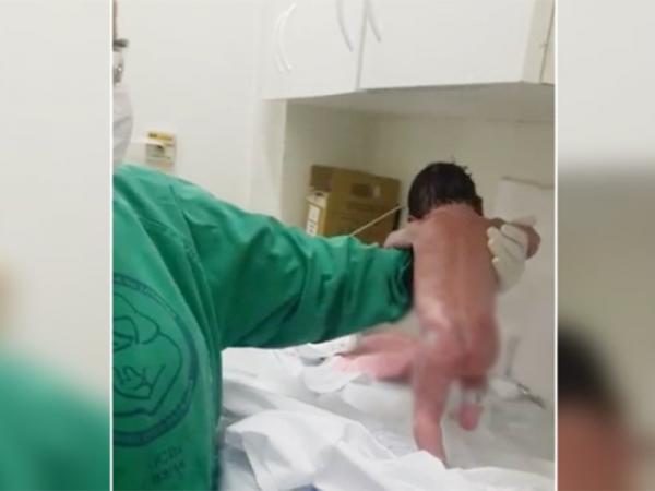 بالفيديو: طفلة برازيلية تمشي بعد دقائق من ولادتها