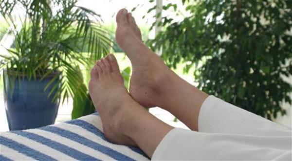 تورم الكاحل في الصيف لا يستدعي القلق