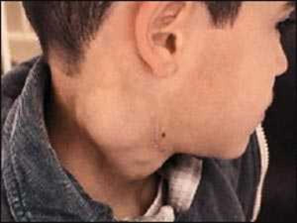 المندوب الإقليمي للصحة بتنغير يُوضح لـ "أخبارنا المغربية" طبيعة المرض الذي أصاب بعض التلاميذ بـ" تيمضرت" وشكل التدخل