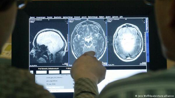 هذه أهم أعراضه.. التصلب المتعدد "مرض بألف وجه"