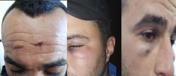 بالفيديو: عصابات إجرامية تستعين بكلب مفترس في مهاجمة مراقبي الحافلات بالقنيطرة