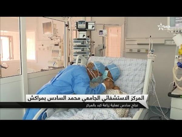 أخ يتبرع بجزء كبير من كبده لانقاذ حياة شقيقه بمراكش