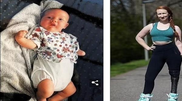 تنجح في ممارسة التزلج على الجليد ورفع الأثقال باستخدام أطراف صناعية