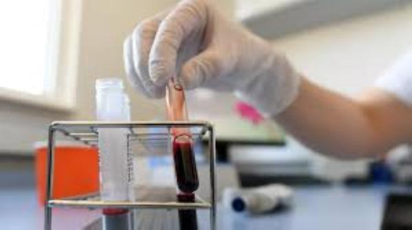 تركيا:شفاء أول مريض بتجربة "البلازما المناعية" ضد فيروس "كورونا"