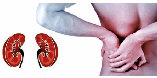 علماء: زرع كلى غير مطابقة أفضل كثيرا من عدمه