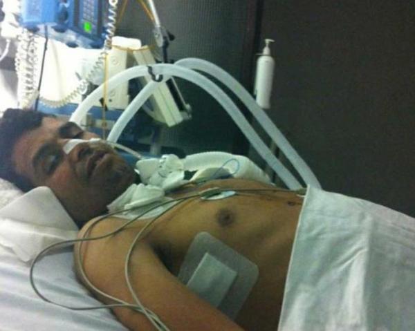 مغربي يصاب بإعاقة دائمة بعد تعرضه للتعذيب على يد الشرطة الإسبانية