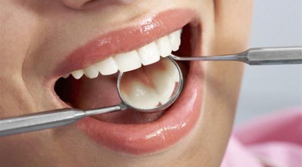 أكثر 5 مشاكل مقلقة للأسنان بعد الـ 40