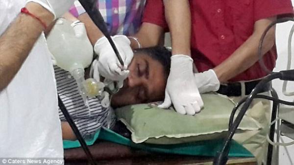 بالفيديو: يتخلص من الاكتئاب بابتلاع 140 عملة نقدية و150 مسماراً