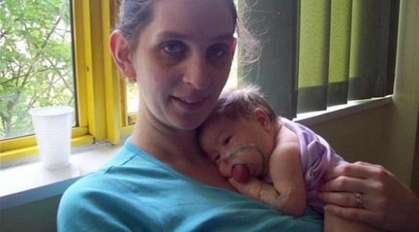 رضيعة تمتلك لساناً يساوي طول وجهها