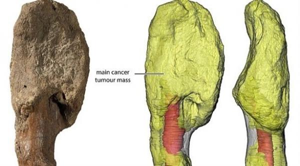 اكتشاف إصابة ديناصور عاش قبل 77 مليون عام بسرطان العظام