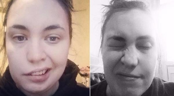 فتاة تستخدم الشريط اللاصق لإغلاق عينيها عند النوم