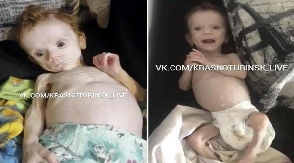 طفلة روسية تكافح للبقاء على قيد الحياة بعد أن اخفيتها والدتها في خزانة ملابسها