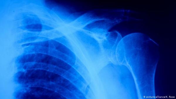 دراسة حديثة تربط بين العظام ونشاط الذاكرة في مرحلة الشيخوخة