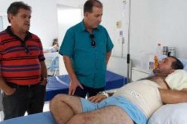 أطباء يزرعون يداً مصابة في معدة المريض