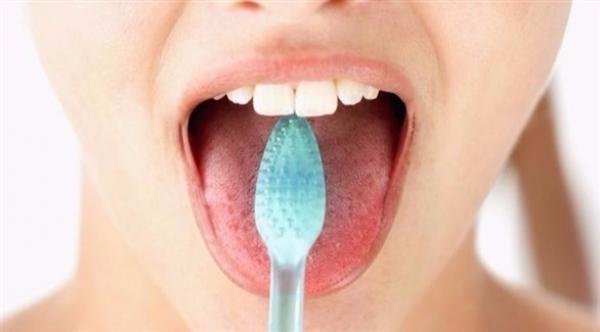 لسانك مؤشر على الإصابة بسرطان الدم